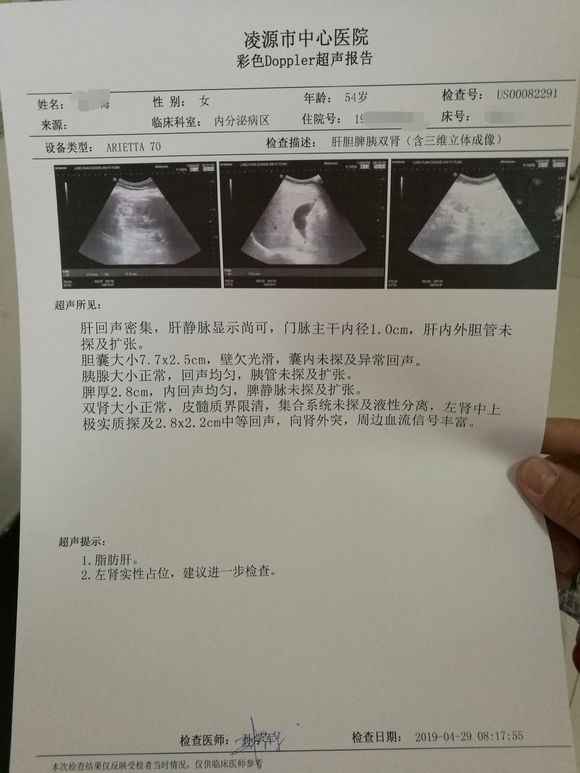 各位朋友好，我想咨询肾脏肿瘤，我的妈妈54岁