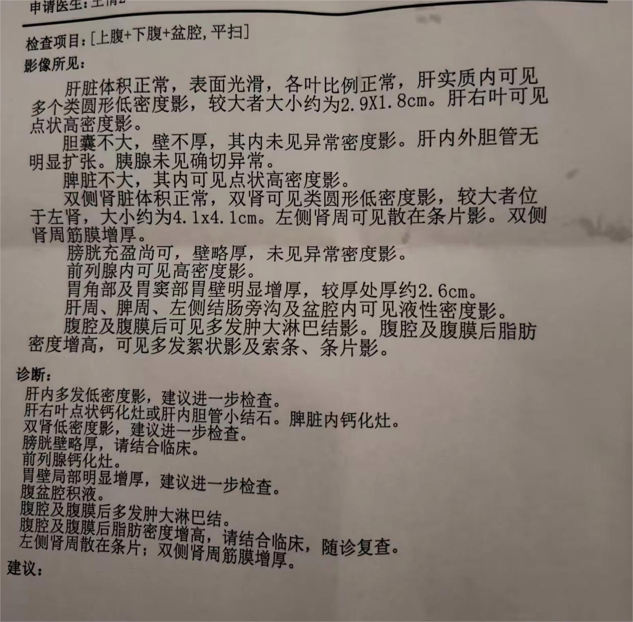 求懂的帮看看老人CT检查结果